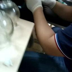 三棱针放血疗法视频,传统中医的神奇疗愈之道